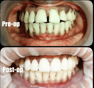Slider image (7) Dr. A & T Dental Experts